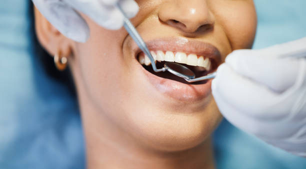 Best Holiday Emergency Dentist in Wood River, IL
